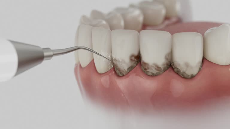 Reliable Dental Implants contractor in Sterlington, LA by Smile Center Dentistry